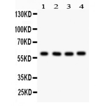 CDC73 / Parafibromin Antibody - HRPT2 antibody Western blot. All lanes: Anti HRPT2 at 0.5 ug/ml. Lane 1: Human Placenta Tissue Lysate at 50 ug. Lane 2: HEPG2 Whole Cell Lysate at 40 ug. Lane 3: 293T Whole Cell Lysate at 40 ug. Lane 4: HELA Whole Cell Lysate at 40 ug. Predicted band size: 61 kD. Observed band size: 61 kD.