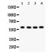 CDC73 / Parafibromin Antibody - HRPT2 antibody Western blot. All lanes: Anti HRPT2 at 0.5 ug/ml. Lane 1: Human Placenta Tissue Lysate at 50 ug. Lane 2: HEPG2 Whole Cell Lysate at 40 ug. Lane 3: 293T Whole Cell Lysate at 40 ug. Lane 4: HELA Whole Cell Lysate at 40 ug. Predicted band size: 61 kD. Observed band size: 61 kD.