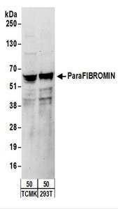 CDC73 / Parafibromin Antibody - Detection of Human and Mouse Para fibromin by Western Blot. Samples: Whole cell lysate (50 ug) from mouse TCMK-1 and human 293T cells. Antibodies: Affinity purified rabbit anti-Parafibromin antibody used for WB at 0.04 ug/ml. Detection: Chemiluminescence with an exposure time of 3 minutes.