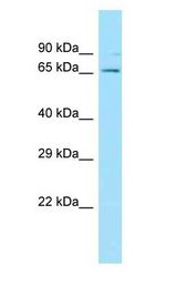 CDC73 / Parafibromin Antibody - CDC73 / Parafibromin antibody Western Blot of MDA-MB-435S.  This image was taken for the unconjugated form of this product. Other forms have not been tested.