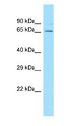 CDC73 / Parafibromin Antibody - CDC73 / Parafibromin antibody Western Blot of MDA-MB-435S.  This image was taken for the unconjugated form of this product. Other forms have not been tested.