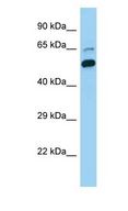 CDC73 / Parafibromin Antibody - CDC73 / Parafibromin antibody Western Blot of Human HeLa Cell. Antibody dilution: 1 ug/ml.  This image was taken for the unconjugated form of this product. Other forms have not been tested.