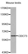CDC73 / Parafibromin Antibody - Western blot analysis of extracts of mouse testis, using CDC73 antibody. The secondary antibody used was an HRP Goat Anti-Rabbit IgG (H+L) at 1:10000 dilution. Lysates were loaded 25ug per lane and 3% nonfat dry milk in TBST was used for blocking.