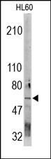 CDC73 / Parafibromin Antibody - The Parafibromin Antibody is used in Western blot to detect Parafibromin in HL-60 cell lysate.