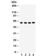 CDC73 / Parafibromin Antibody
