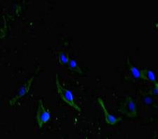 CDC73 / Parafibromin Antibody - Immunofluorescent analysis of Hela cells diluted at 1:100 and Alexa Fluor 488-congugated AffiniPure Goat Anti-Rabbit IgG(H+L)