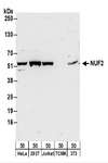 CDCA1 / NUF2 Antibody - Detection of Human and Mouse NUF2 by Western Blot. Samples: Whole cell lysate (50 ug) from HeLa, 293T, Jurkat, mouse TCMK-1, and mouse NIH3T3 cells. Antibodies: Affinity purified rabbit anti-NUF2 antibody used for WB at 0.4 ug/ml. Detection: Chemiluminescence with an exposure time of 30 seconds.
