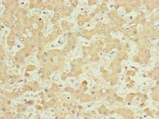 CDCA1 / NUF2 Antibody - Immunohistochemistry of paraffin-embedded human liver tissue at dilution of 1:100
