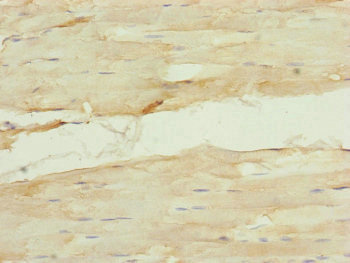 CDCA1 / NUF2 Antibody - Immunohistochemistry of paraffin-embedded human skeletal muscle tissue at dilution of 1:100