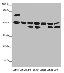 CDCA1 / NUF2 Antibody - Western blot All Lanes:NUF2 antibody at 5.29 ug/ml Lane 1: Mouse liver tissue Lane 2: Jurkat whole cell lysate Lane 3: A431 whole cell lysate Lane 4: PC-3 whole cell lysate Lane 5: 293T whole cell lysate Lane 6: Hela whole cell lysate Lane 7: HepG-2 whole cell lysate Secondary Goat polyclonal to rabbit IgG at 1/10000 dilution Predicted band size: 54 kDa Observed band size: 54,45,65 kDa