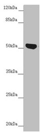 CDCA1 / NUF2 Antibody - Western blot All lanes: NUF2 antibody at 5.29µg/ml + Jurkat whole cell lysate Secondary Goat polyclonal to rabbit IgG at 1/10000 dilution Predicted band size: 54 kDa Observed band size: 54 kDa