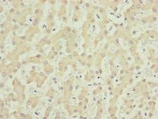 CDCA1 / NUF2 Antibody - Immunohistochemistry of paraffin-embedded human liver tissue at dilution of 1:100