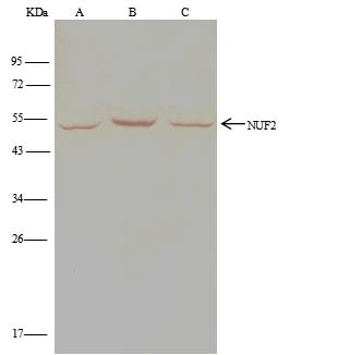 CDCA1 / NUF2 Antibody - Nuf2 was immunoprecipitated using: Lane A: 0.5 mg A431 Whole Cell Lysate. Lane B: 0.5 mg Jurkat Whole Cell Lysate. Lane C:0.5 mg HepG2 Whole Cell Lysate. 1 uL anti-Nuf2 rabbit polyclonal antibody and 15 ul of 50% Protein G agarose. Primary antibody: Anti-Nuf2 rabbit polyclonal antibody, at 1:500 dilution. Secondary antibody: Clean-Blot IP Detection Reagent (HRP) at 1:500 dilution. Developed using the DAB staining technique. Performed under reducing conditions. Predicted band size: 51 kDa. Observed band size: 51 kDa.