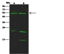 CDCA1 / NUF2 Antibody - Anti-Nuf2 rabbit polyclonal antibody at 1:500 dilution. Lane A: A431 Whole Cell Lysate. Lane B: Jurkat Whole Cell Lysate. Lysates/proteins at 30 ug per lane. Secondary: Goat Anti-Rabbit IgG H&L (Dylight 800) at 1/10000 dilution. Developed using the Odyssey technique. Performed under reducing conditions. Predicted band size: 54 kDa. Observed band size: 54 kDa. (We are unsure as to the identity of these extra bands.)