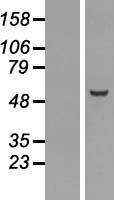 CDCA1 / NUF2 Protein - Western validation with an anti-DDK antibody * L: Control HEK293 lysate R: Over-expression lysate