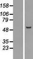 CDCA1 / NUF2 Protein - Western validation with an anti-DDK antibody * L: Control HEK293 lysate R: Over-expression lysate