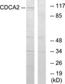CDCA2 Antibody - Western blot analysis of lysates from 293 cells, using CDCA2 Antibody. The lane on the right is blocked with the synthesized peptide.