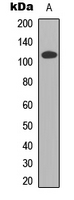 CDCA2 Antibody - Western blot analysis of CDCA2 expression in HEK293T (A) whole cell lysates.