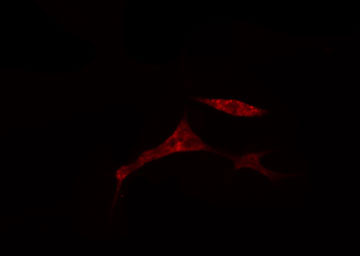 CDCA2 Antibody - Staining 293 cells by IF/ICC. The samples were fixed with PFA and permeabilized in 0.1% Triton X-100, then blocked in 10% serum for 45 min at 25°C. The primary antibody was diluted at 1:200 and incubated with the sample for 1 hour at 37°C. An Alexa Fluor 594 conjugated goat anti-rabbit IgG (H+L) antibody, diluted at 1/600, was used as secondary antibody.