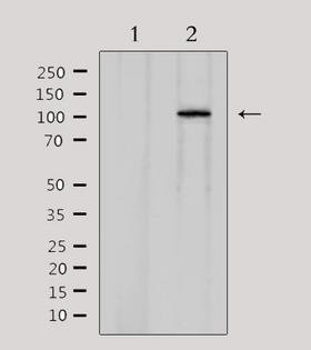 CDCA2 Antibody - Western blot analysis of extracts of rat brain tissue using CDCA2 antibody. Lane 1 was treated with the antigen-specific peptide.