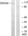 CDCA2 Antibody - Western blot analysis of extracts from 293 cells, using CDCA2 antibody.
