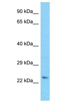 CDCA3 Antibody - CDCA3 antibody Western Blot of HCT15. Antibody dilution: 1 ug/ml.  This image was taken for the unconjugated form of this product. Other forms have not been tested.