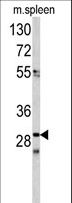 CDCA3 Antibody - Western blot of CDCA3 antibody in mouse spleen tissue lysates(35 ug/lane). CDCA3 (arrow) was detected using the purified antibody.