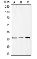 CDCA3 Antibody - Western blot analysis of CDCA3 expression in MCF7 (A); Caco2 (B); HepG2 (C) whole cell lysates.