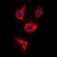 CDCA3 Antibody - Immunofluorescent analysis of CDCA3 staining in MCF7 cells. Formalin-fixed cells were permeabilized with 0.1% Triton X-100 in TBS for 5-10 minutes and blocked with 3% BSA-PBS for 30 minutes at room temperature. Cells were probed with the primary antibody in 3% BSA-PBS and incubated overnight at 4 C in a humidified chamber. Cells were washed with PBST and incubated with a DyLight 594-conjugated secondary antibody (red) in PBS at room temperature in the dark. DAPI was used to stain the cell nuclei (blue).