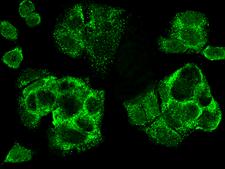 CDCA3 Antibody - Immunofluorescence staining of CDCA3 in MCF7 cells. Cells were fixed with 4% PFA, permeabilzed with 0.3% Triton X-100 in PBS, blocked with 10% serum, and incubated with rabbit anti-human CDCA3 polyclonal antibody (dilution ratio: 1:1000) at 4°C overnight. Then cells were stained with the Alexa Fluor 488-conjugated Goat Anti-rabbit IgG secondary antibody (green)Positive staining was localized to cytoplasm.