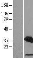 CDCA3 Protein - Western validation with an anti-DDK antibody * L: Control HEK293 lysate R: Over-expression lysate
