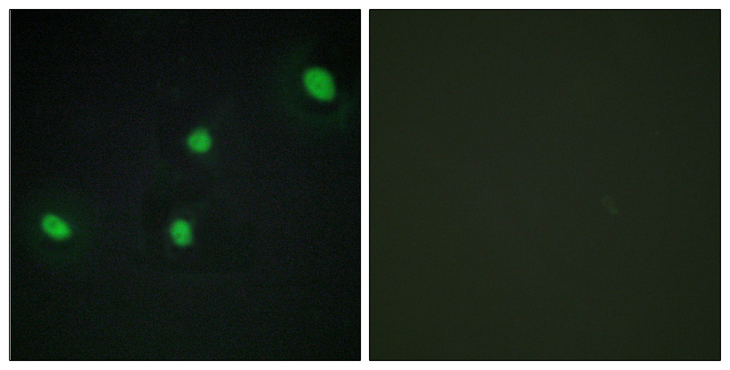CDCA4 Antibody - Immunofluorescence analysis of HepG2 cells, using CDCA4 Antibody. The picture on the right is blocked with the synthesized peptide.