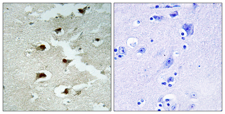 CDCA4 Antibody - Immunohistochemistry analysis of paraffin-embedded human brain tissue, using CDCA4 Antibody. The picture on the right is blocked with the synthesized peptide.