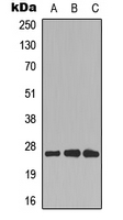 CDCA4 Antibody - Western blot analysis of CDCA4 expression in HEK293T (A); COLO205 (B); rat muscle (C) whole cell lysates.