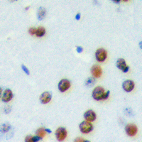 CDCA4 Antibody - Immunohistochemical analysis of CDCA4 staining in human brain formalin fixed paraffin embedded tissue section. The section was pre-treated using heat mediated antigen retrieval with sodium citrate buffer (pH 6.0). The section was then incubated with the antibody at room temperature and detected using an HRP conjugated compact polymer system. DAB was used as the chromogen. The section was then counterstained with hematoxylin and mounted with DPX.