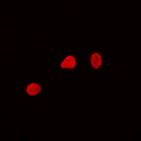 CDCA4 Antibody - Immunofluorescent analysis of CDCA4 staining in HEK293T cells. Formalin-fixed cells were permeabilized with 0.1% Triton X-100 in TBS for 5-10 minutes and blocked with 3% BSA-PBS for 30 minutes at room temperature. Cells were probed with the primary antibody in 3% BSA-PBS and incubated overnight at 4 ??C in a humidified chamber. Cells were washed with PBST and incubated with a DyLight 594-conjugated secondary antibody (red) in PBS at room temperature in the dark. DAPI was used to stain the cell nuclei (blue).