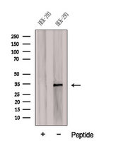 CDCA4 Antibody - Western blot analysis of extracts of C6 cells using CDCA4 antibody. The lane on the left was treated with blocking peptide.