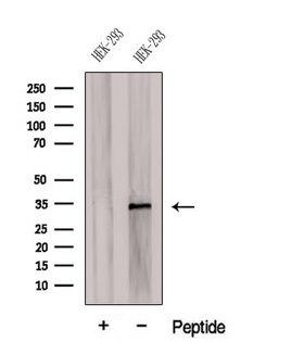 CDCA4 Antibody - Western blot analysis of extracts of C6 cells using CDCA4 antibody. The lane on the left was treated with blocking peptide.