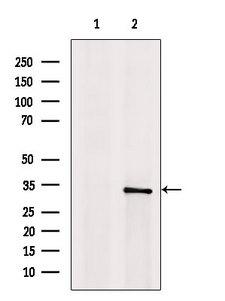 CDCA4 Antibody