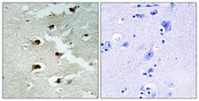 CDCA4 Antibody - Peptide - + Immunohistochemistry analysis of paraffin-embedded human brain tissue using CDCA4 antibody.
