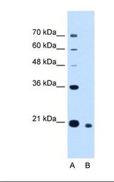CDCA4 Antibody - Lane A: Marker. Lane B: HepG2 cell lysate. Antibody concentration: 2.5 ug/ml. Gel concentration: 12%.  This image was taken for the unconjugated form of this product. Other forms have not been tested.