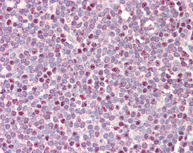 CDCA5 / Sororin Antibody - Anti-CDCA5 / Sororin antibody IHC staining of human tonsil. Immunohistochemistry of formalin-fixed, paraffin-embedded tissue after heat-induced antigen retrieval. Antibody concentration 10 ug/ml.  This image was taken for the unconjugated form of this product. Other forms have not been tested.