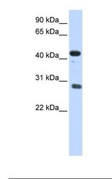 CDCA5 / Sororin Antibody - Placenta lysate. Antibody concentration: 1.0 ug/ml. Gel concentration: 12%.  This image was taken for the unconjugated form of this product. Other forms have not been tested.