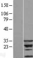 CDCA5 / Sororin Protein - Western validation with an anti-DDK antibody * L: Control HEK293 lysate R: Over-expression lysate
