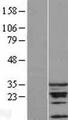 CDCA5 / Sororin Protein - Western validation with an anti-DDK antibody * L: Control HEK293 lysate R: Over-expression lysate