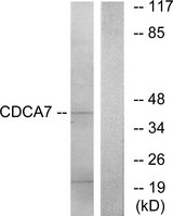 CDCA7 Antibody - Western blot analysis of lysates from K562 cells, using CDCA7 Antibody. The lane on the right is blocked with the synthesized peptide.