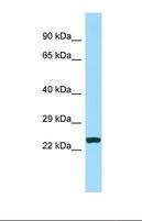 CDCA7 Antibody - Western blot of Human MCF7. CDCA7 antibody dilution 1.0 ug/ml.  This image was taken for the unconjugated form of this product. Other forms have not been tested.