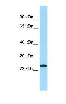 CDCA7 Antibody - Western blot of Human MCF7. CDCA7 antibody dilution 1.0 ug/ml.  This image was taken for the unconjugated form of this product. Other forms have not been tested.