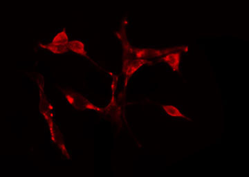 CDCA7 Antibody - Staining HeLa cells by IF/ICC. The samples were fixed with PFA and permeabilized in 0.1% Triton X-100, then blocked in 10% serum for 45 min at 25°C. The primary antibody was diluted at 1:200 and incubated with the sample for 1 hour at 37°C. An Alexa Fluor 594 conjugated goat anti-rabbit IgG (H+L) antibody, diluted at 1/600, was used as secondary antibody.