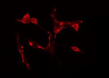 CDCA7 Antibody - Staining HeLa cells by IF/ICC. The samples were fixed with PFA and permeabilized in 0.1% Triton X-100, then blocked in 10% serum for 45 min at 25°C. The primary antibody was diluted at 1:200 and incubated with the sample for 1 hour at 37°C. An Alexa Fluor 594 conjugated goat anti-rabbit IgG (H+L) antibody, diluted at 1/600, was used as secondary antibody.